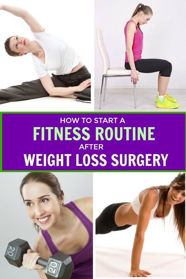 Gastric Bypass, Post Surgery, Lose 50 Pounds, Lose Belly, Fitness Workout, Lose Belly Fat, Surgery, Vitamins, To Start