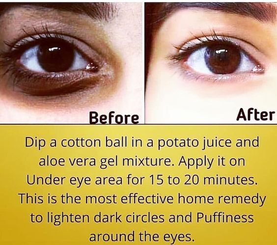 Exposed Skin Care, Clear Healthy Skin, Natural Skin Care Remedies, Natural Face Skin Care, Good Skin Tips, Skin Care Face Mask, Beauty Tips For Glowing Skin, Perfect Skin Care Routine, Homemade Beauty Tips