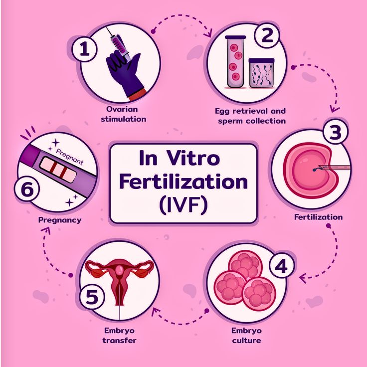 Ivf center in delhi In Vitro Fertilization Process, Ivf Implantation, Fertilization Process, Invitro Fertilization, Ivf Procedure, Healthy Heart Tips, Ivf Pregnancy, English Project, Premature Birth