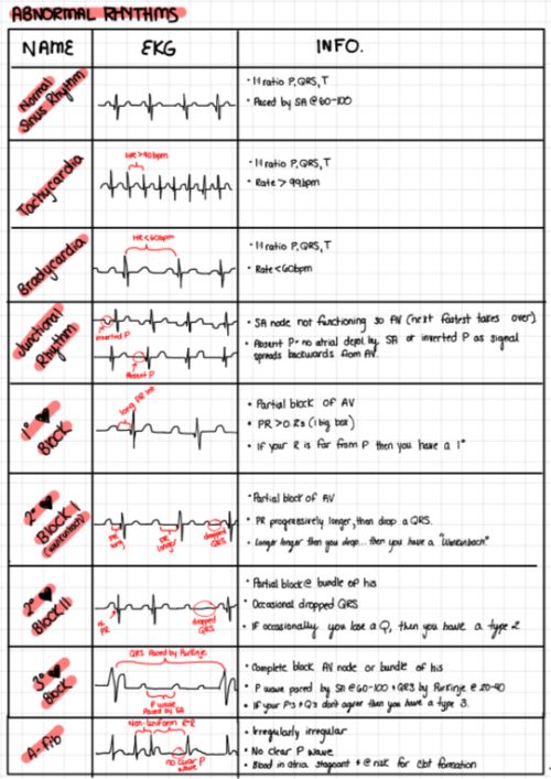 Free Printable Ekg Practice Test And Answers