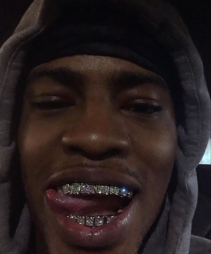 Pretty Teeth, Dental Jewelry, Grillz Teeth, Gold Grill, Grills Teeth, Nice Teeth, Tooth Gem, Teeth Jewelry, Cute Black Guys