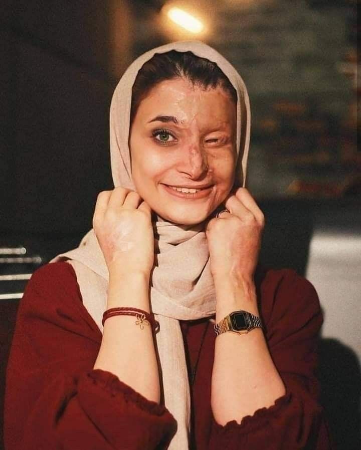 a woman wearing a headscarf smiles at the camera with her hands on her face