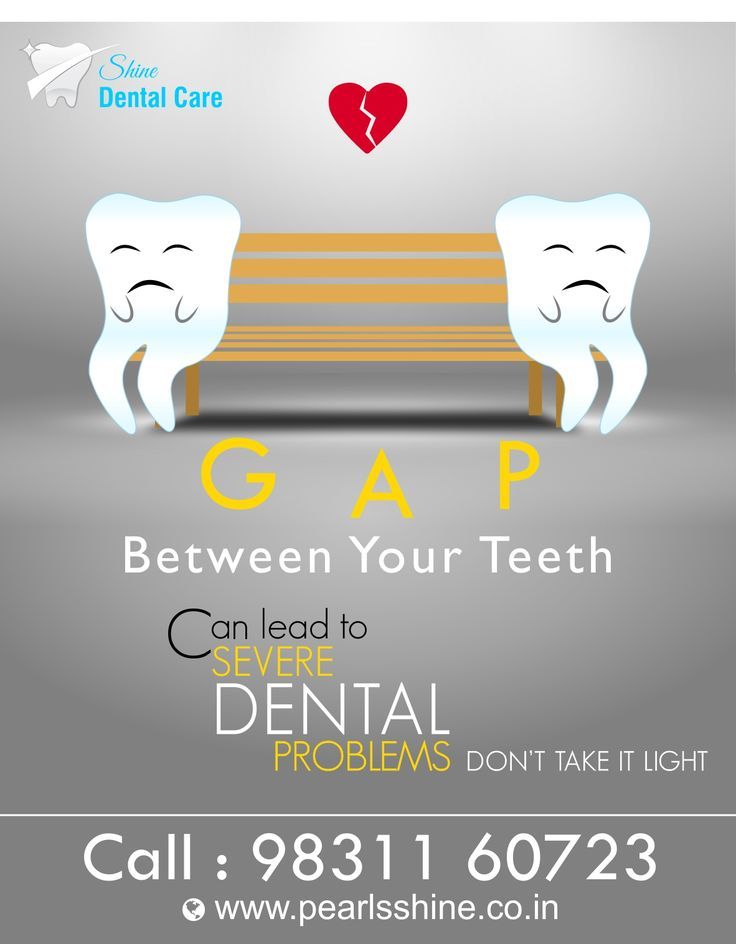 Dental Clinic Promotion Ideas, Dental Care Creative Ads, Dental Promotion Ideas, Dental Meme, Dentist Advertising, Dental Ads, Dentist Marketing, Dental Wallpaper, Dental Quotes