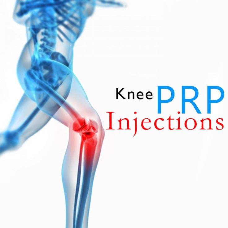 Knee PRP Injections Stem Cell Therapy, Cell Therapy, Muscle Strain, Regenerative Medicine, Keep Calm And Love, Hair Restoration, Stem Cells, Helping People, Anti Aging