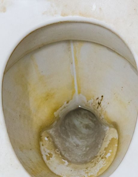 a dirty toilet bowl with the lid up