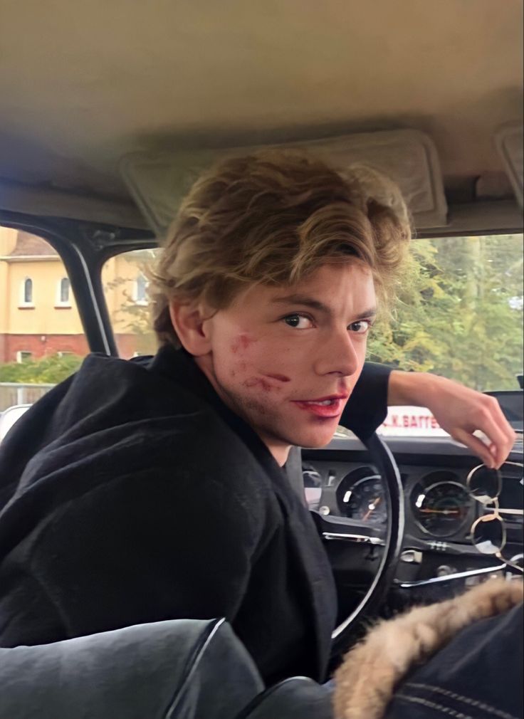 a young man is sitting in the driver's seat of a car with blood on his face