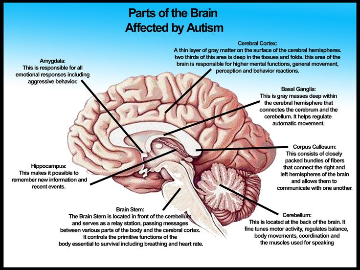 The autistic brain-School of Medicine study shows autistic brains create more information at rest Possible explanation for “withdrawal into self,” a characteristic of the disorder  Research news February 10, 2014 The Daily CWRU Parts Of The Brain, Basal Ganglia, Corpus Callosum, Cerebral Cortex, Cohort Study, Health Topics, Processing Disorder, Sensory Issues, Gray Matters