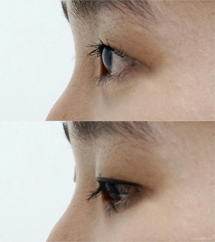 two pictures of the same person's eyes