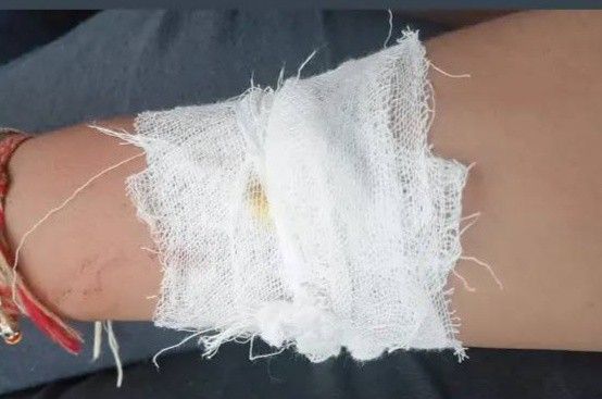 a woman's arm is covered with white fabric and red string wrapped around it