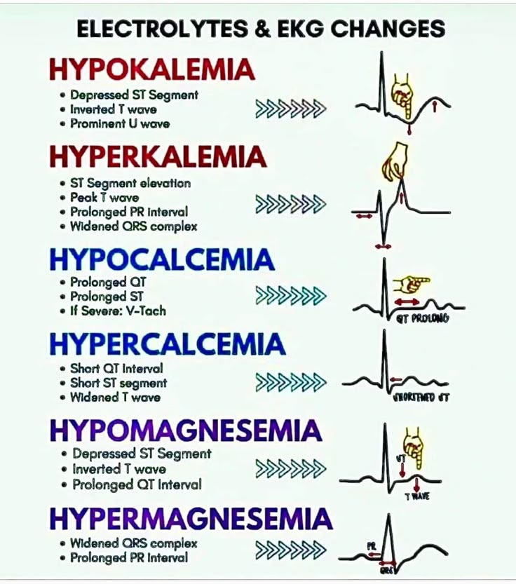 Paramedic Motivation, Ekg Rhythms, Medical Assistant Student, Paramedic School, Nursing School Essential, Nurse Study, Kedokteran Gigi, Medical School Life, Nursing School Motivation