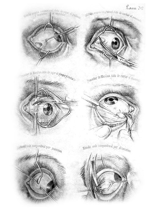 an eye diagram showing different parts of the iris