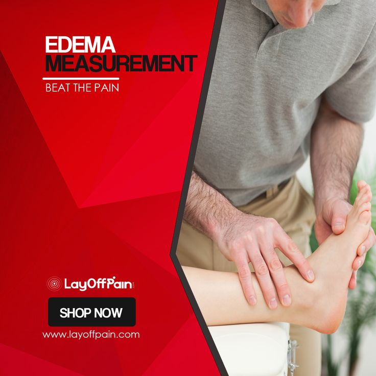 Edema (or Oedema) is the abnormal accumulation of fluid in certain tissues within the body. Keep an eye on the presence of edema with our Volumetric Measuring Devices and know that you can beat the pressure pain! https://goo.gl/U4EY4z #edema #pain #beatthepain #LayOffPain An Eye, The Body