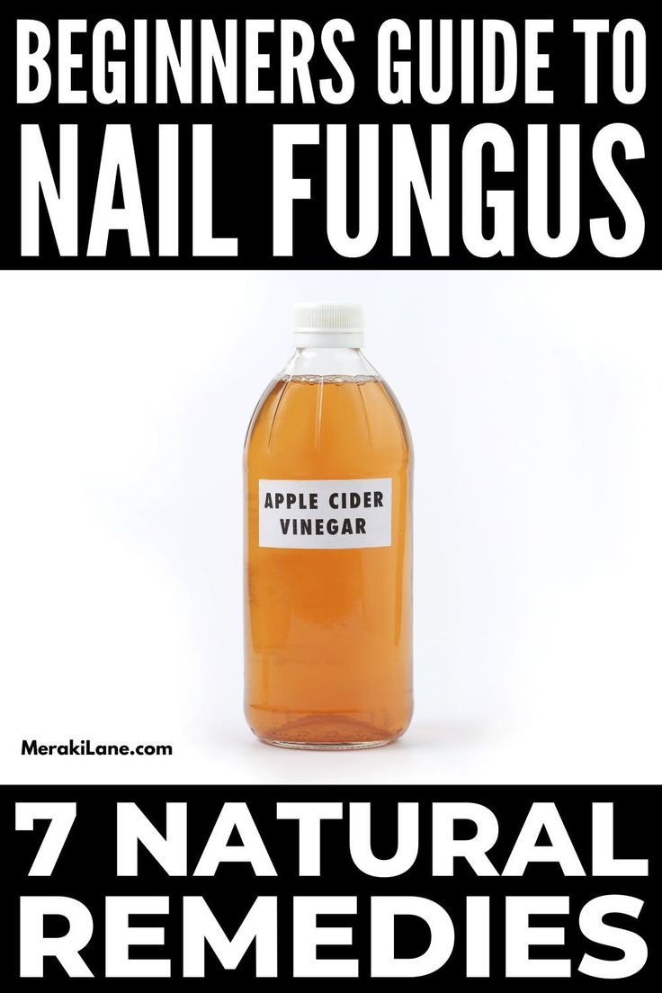 toenail fungus vinegar Black Toenail Fungus, Fungal Infection Remedies, Toenail Fungal Infection, Nail Remedies, Fingernail Fungus, Toenail Fungus Remedies, Nail Fungus Remedy, Nail Infection, Fungal Nail