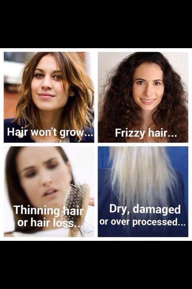 No matter which one you are...Monat had the answer for you!!!  www.AuNaturale.mymonat.com Hair Wont Grow, Aging Hair Care, Anti Aging Hair, Hair Quiz, Hair Issues, Hair Thinning, Hair Dry, Monat Hair, Hair Problems