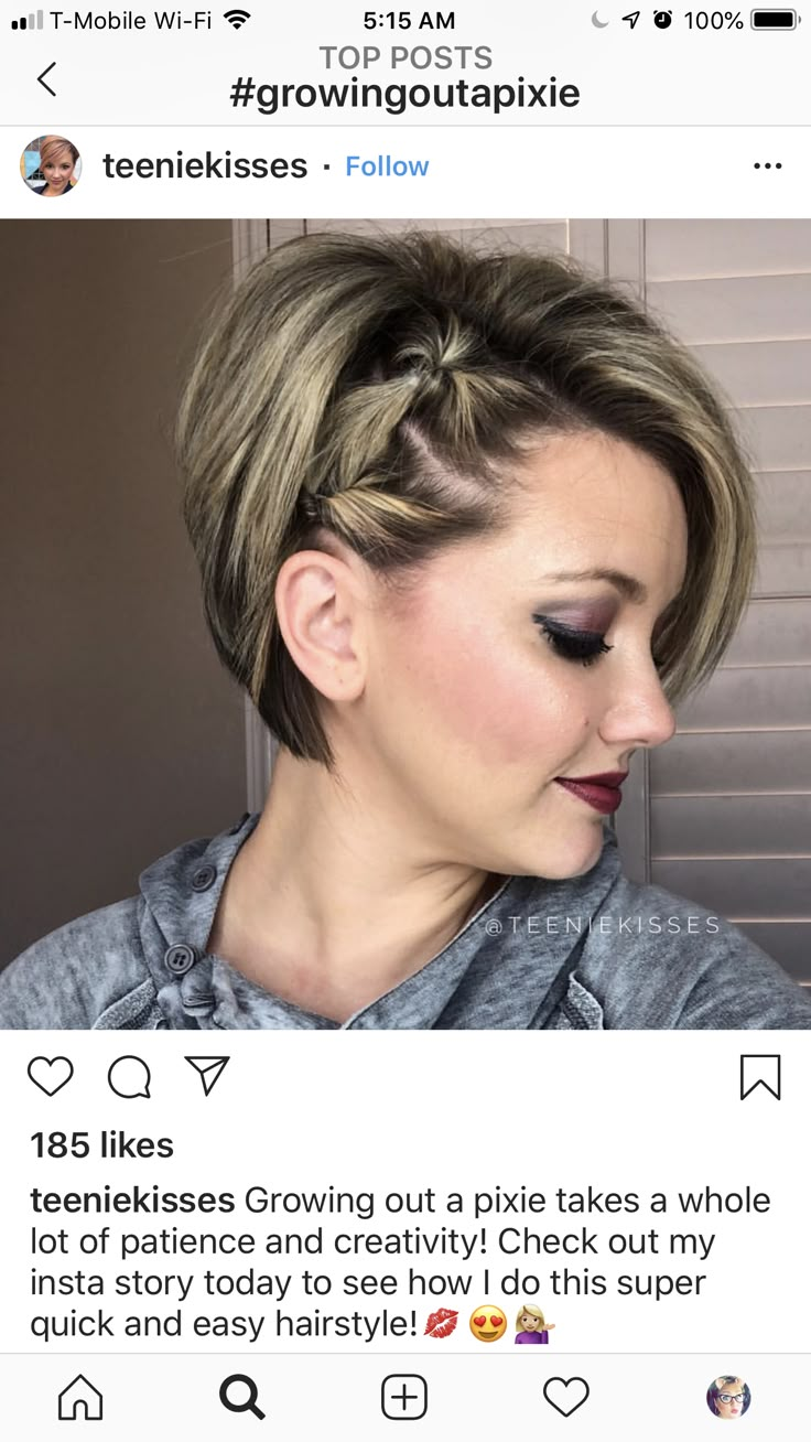 Pixie Braids Hairstyles, Aesthetic Surgeon, Pixie Braids, Short Hair Dos, Short Hairdos, Short Sassy Hair, Dance Hairstyles, Daily Hairstyles, Hairdos For Short Hair