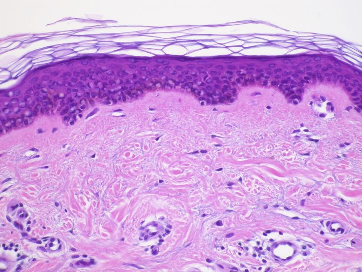 Skin Tissue Section What Is Skin, Hypertrophic Scars, Skin Tissue, Cross Section, Skin Care Kit, Sagging Skin, Healing Process, Skin Cells, Rocks And Crystals