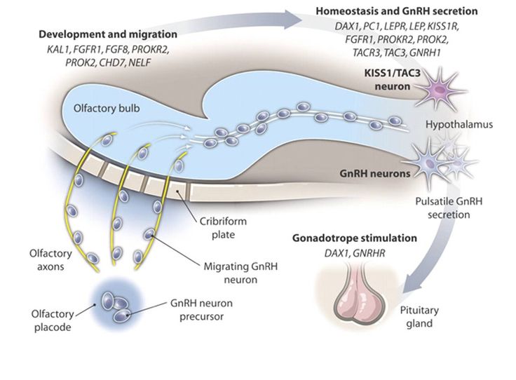 Related image Kallmann Syndrome, Sense Of Smell, Genetic Disorders, Blog Site, Blog Sites, Cardiology, Med School, School Stuff, Sense