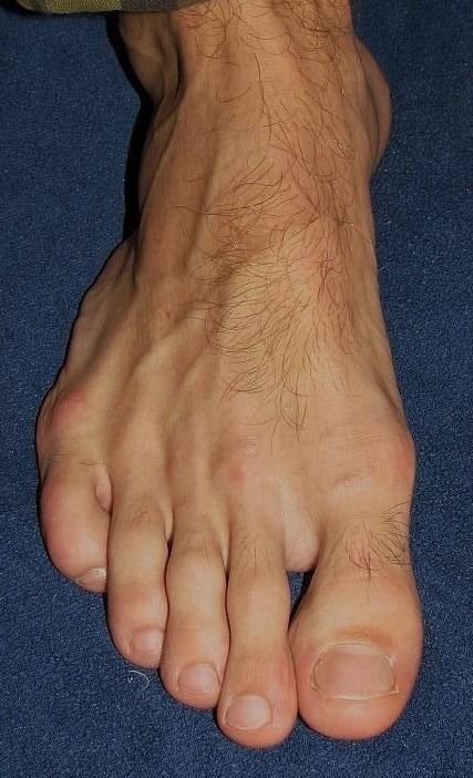 a close up of a person's bare foot on a blue carpet