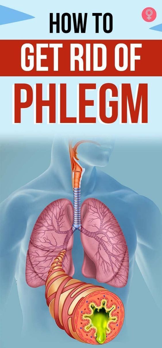 Remedies For Phlegm Cough, Homeopathic Remedies For Mucus, Essential Oils For Phlegm In Throat, Mucus Causing Foods, Natural Remedies For Phlegm, Cough And Phlegm Remedies, Cough With Phlegm Remedies, Natural Remedy For Cough And Mucus, Home Remedy For Cough And Mucus