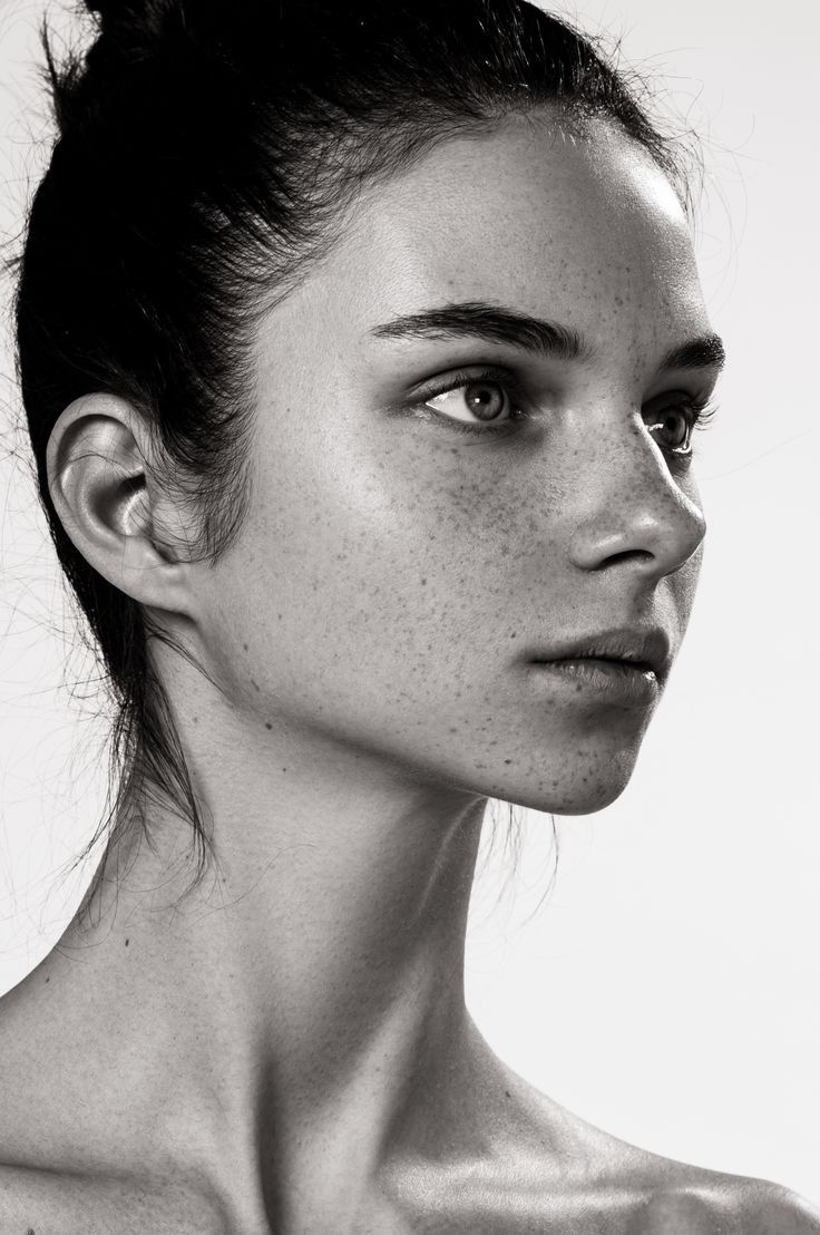 a black and white photo of a woman with freckles