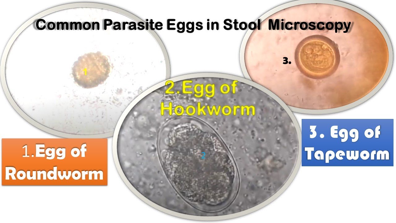 Parasite Egg In Stool