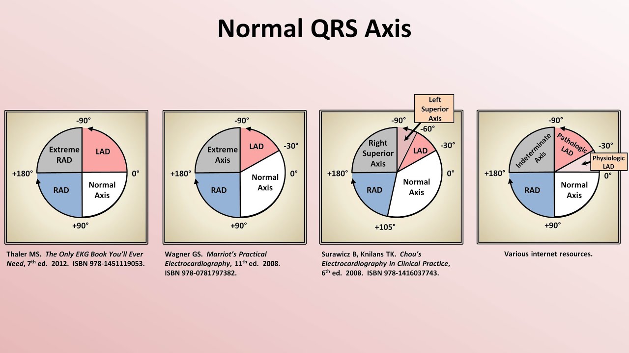 Ekg Axis