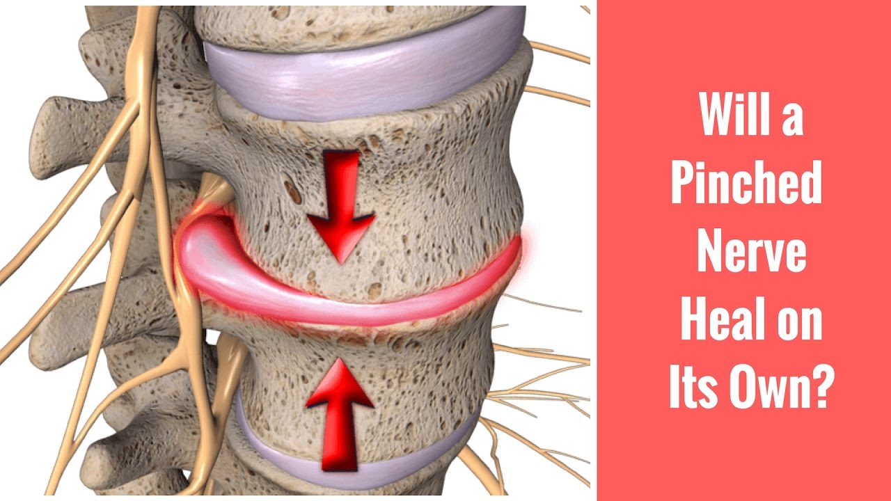 pâlpâire răsărit fizic cure for trapped nerve alfabetizare liniștit ...