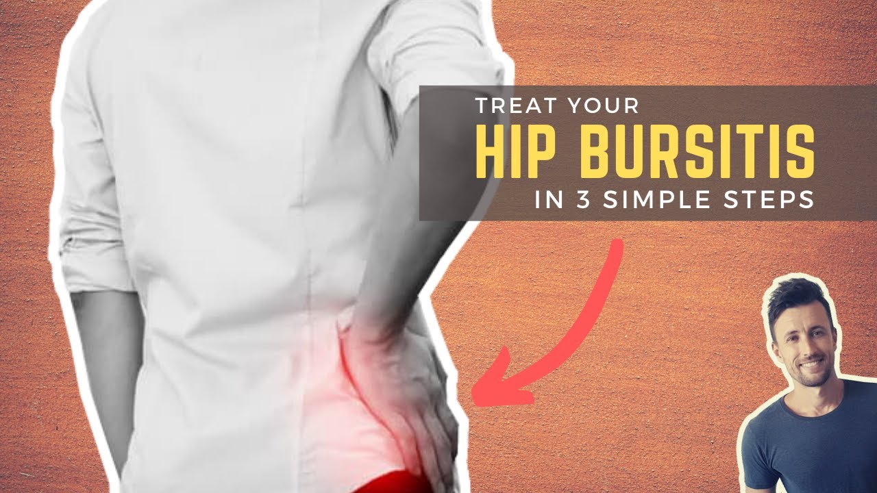 Fix Hip Bursitis In Simple Steps Bursitis Hip Bursitis Hips | The Best ...