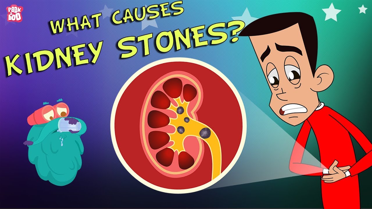 Cartoon Kidney Stone