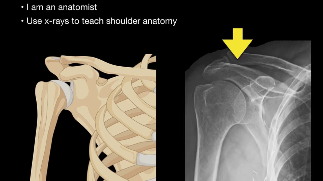 Scapula Anatomy Xray