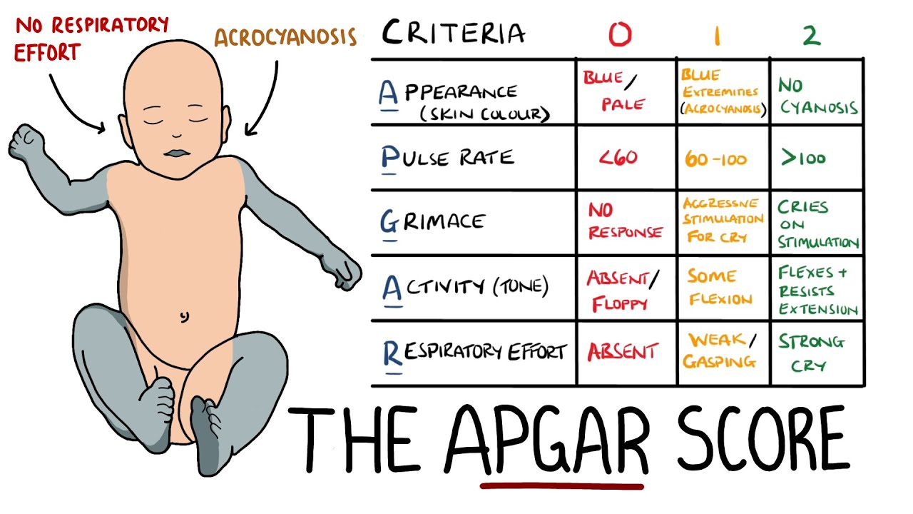 Apgar Score Made Easy Newborn Assessment Apgar Mnemonic Youtube | My ...