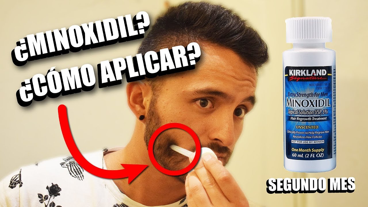 BARBA MINÓXIDIL Segundo mes | ¿Cómo aplicar minoxidil? | Adrián Flores ...