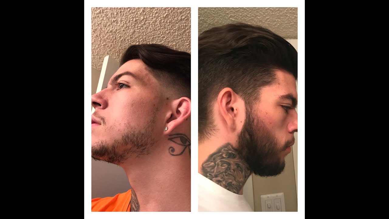 Minoxidil Before And After Beard Result - How Effective Is Minoxidil