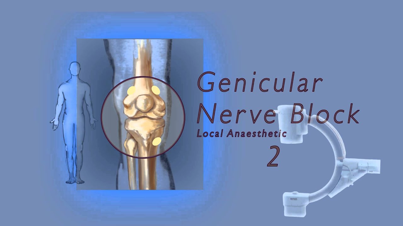 Knee Nerve Block Procedure