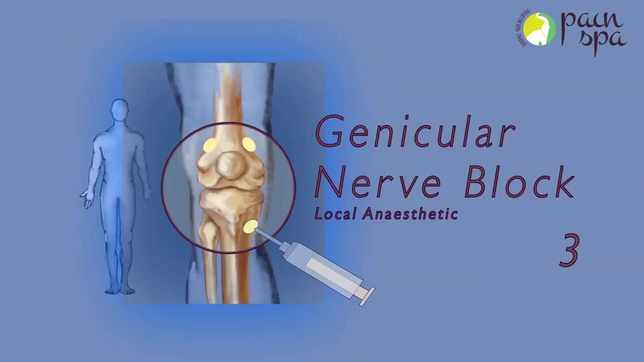 Knee Nerve Block Procedure