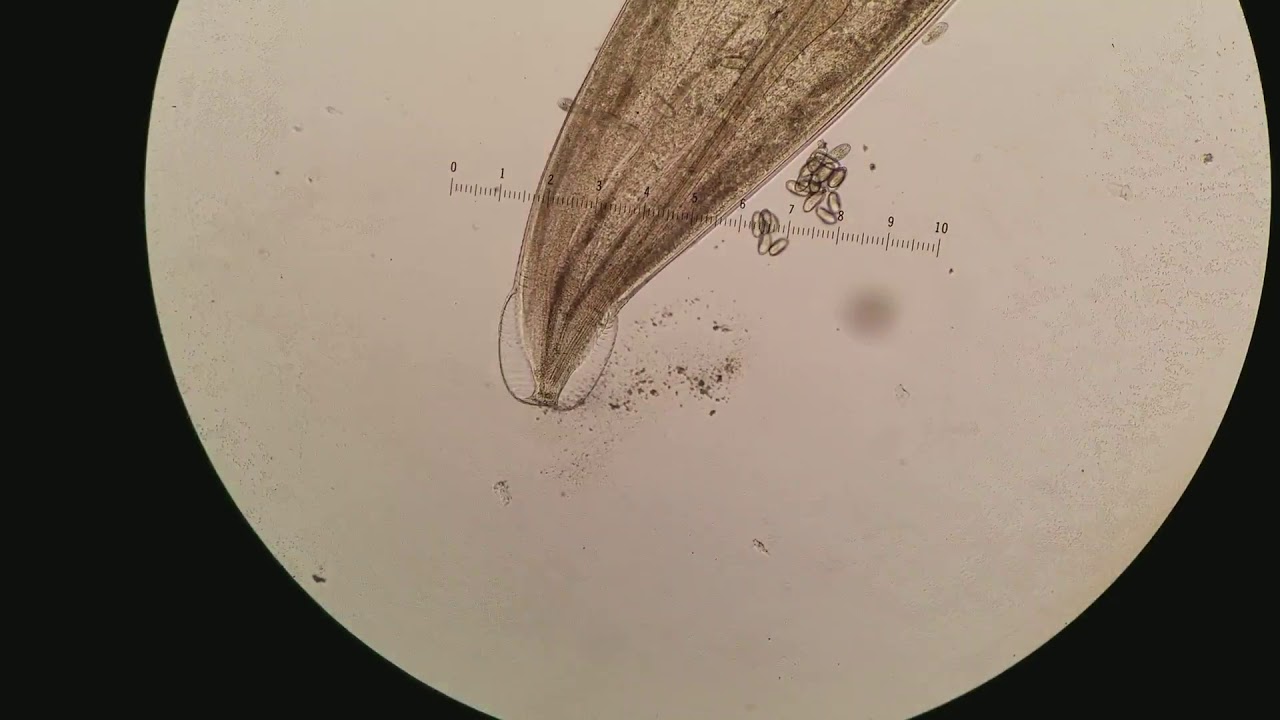 Pinworm Under Microscope