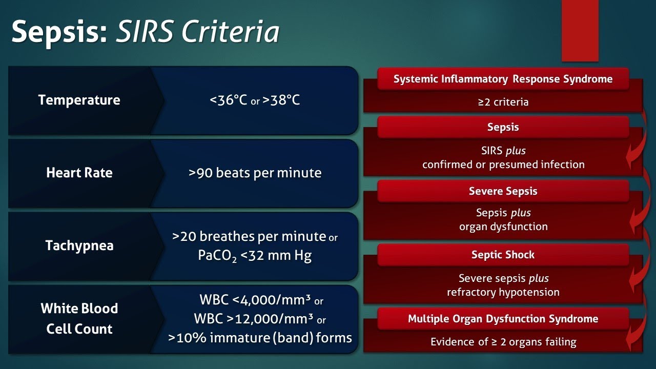 Sepsis Systemic Inflammatory Response Syndrome Sirs Sepsis | The Best ...