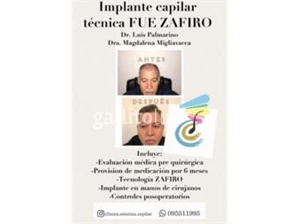 https://www.gallito.com.uy/clinica-estetica-capilar-argentina-dr-luis-palmarino-servicios-22862450