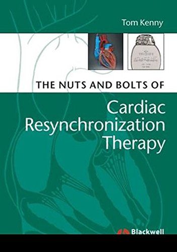 The Nuts and Bolts of Cardiac Resynchronization Therapy: 2 (Nuts and Bolts Series (Replaced by 5113))