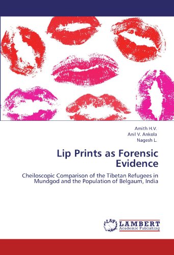 Lip Prints as Forensic Evidence: Cheiloscopic Comparison of the Tibetan Refugees in Mundgod and the Population of Belgaum, India