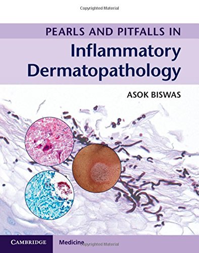 Pearls and Pitfalls in Inflammatory Dermatopathology Hardcover – 30 Mar. 2017