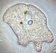 Bestand:Amoeba1.jpg