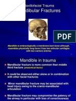 Mandibular Fractres