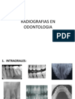 Tipos de Radiografias