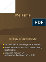 Melasma