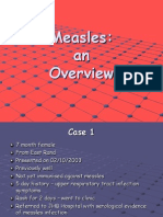 Measles