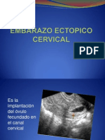 Embarazo Ectopico Cervical 1