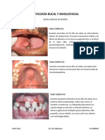 Patología Bucal y Maxilofacial