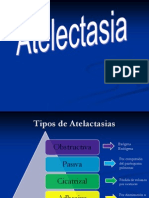 Atelactasia Imagen