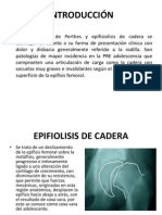 Epifiolisis de Cadera